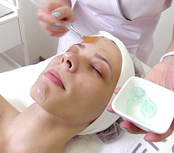 Chemický peeling 5